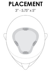 easipart XL placement