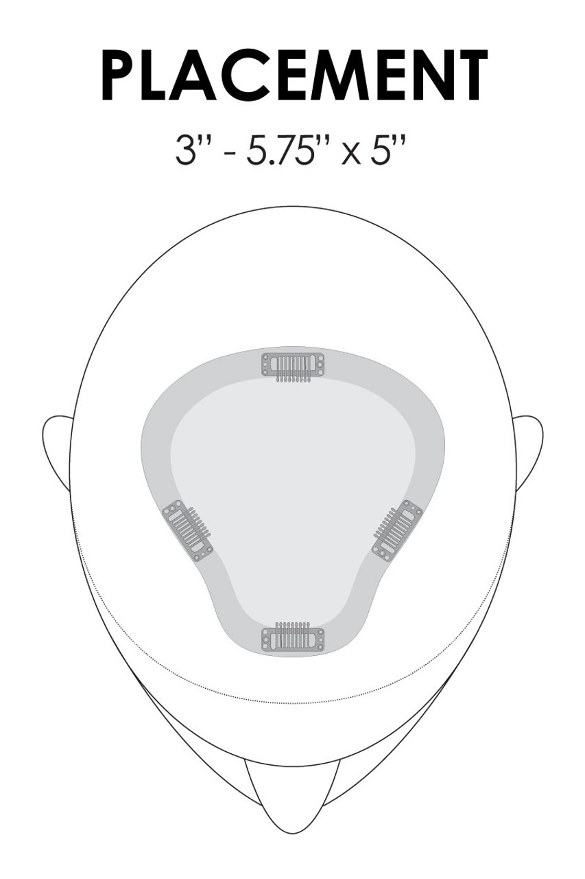 easipart XL placement